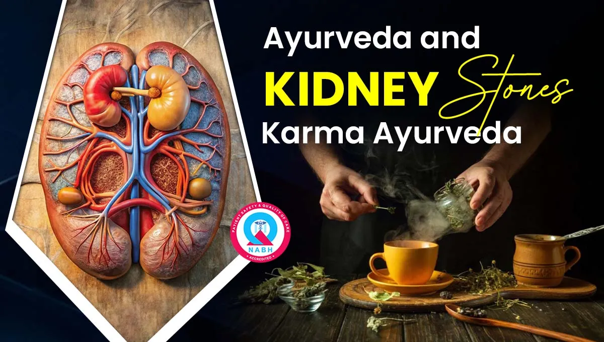 ayurveda-and-kidney-stones